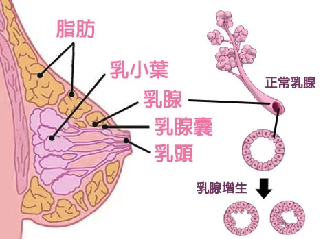 pic(disease2).jpg